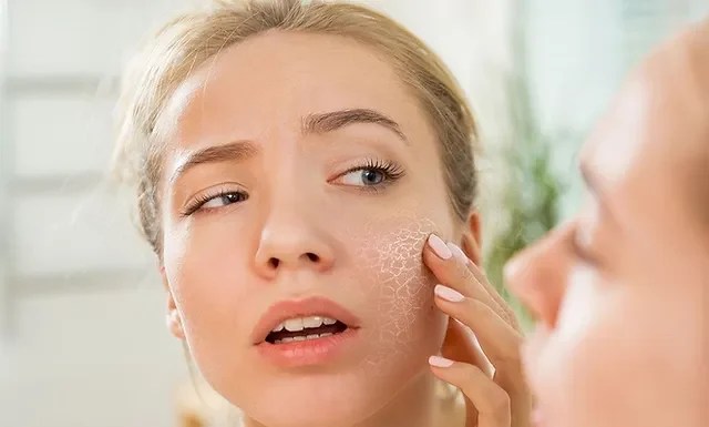 Como o Clima Influencia a Pele Seca e Maneiras de Protegê-la