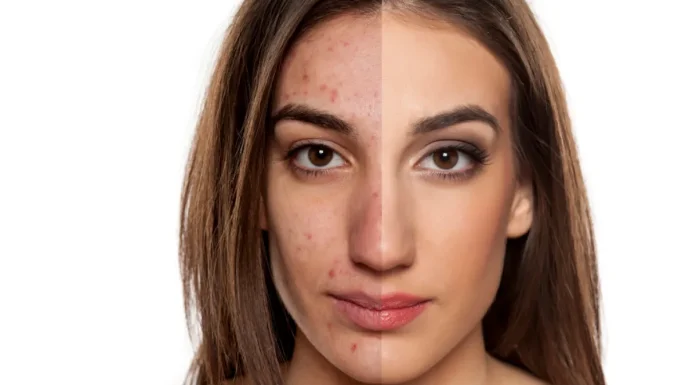 Guia definitivo para remover maquiagem pesada antes de dormir