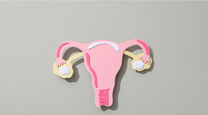 DIU: tudo o que você precisa saber antes de escolher esse método