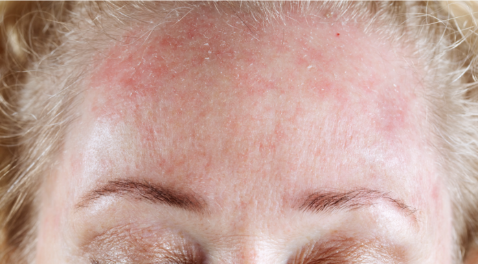 Pele seca? Veja como criar uma rotina noturna hidratante