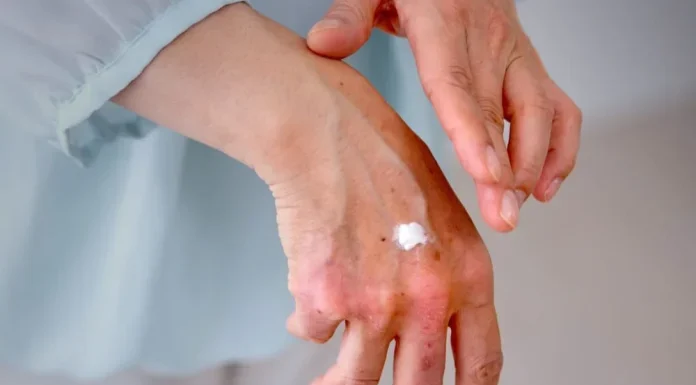 Entenda Por Que Suas Mãos e Pés Têm um Tom Mais Escuro