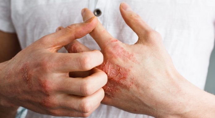 Descamação da Pele: O Que Pode Ser Alergia ou Condição Dermatológica?