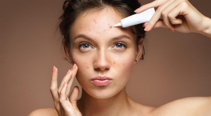 Desvendando a Acne: Como Entender e Melhorar a Saúde da Sua Pele